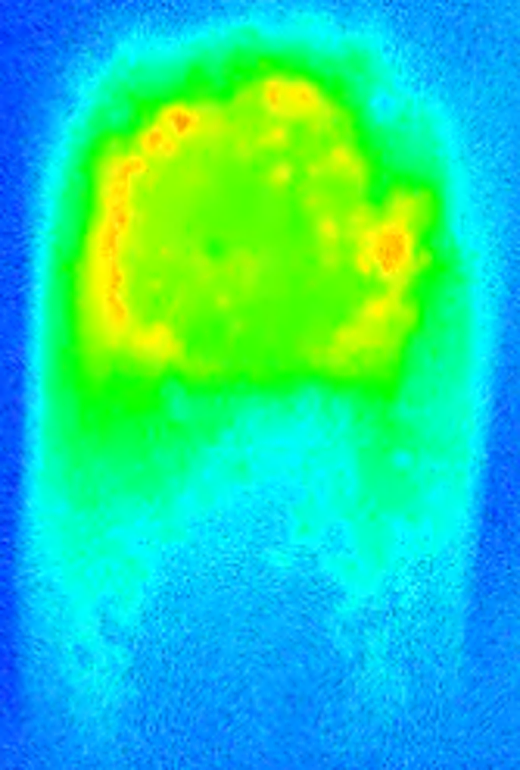 MeltCam melt pool thermal image